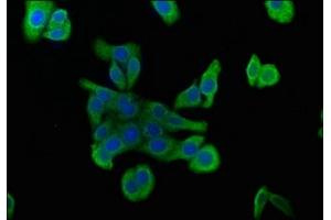 Immunofluorescence staining of HepG2 cells with ABIN7175710 at 1:100, counter-stained with DAPI. (MORG1 antibody  (AA 64-315))