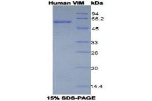 SDS-PAGE (SDS) image for Vimentin (VIM) (AA 2-466) protein (His tag) (ABIN1081166) (Vimentin Protein (VIM) (AA 2-466) (His tag))