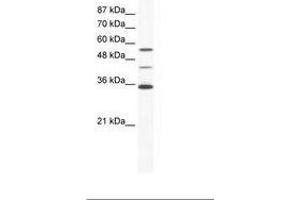 Image no. 1 for anti-ALX Homeobox 4 (ALX4) (AA 31-80) antibody (ABIN202460)