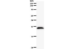Western Blotting (WB) image for anti-NIMA related kinase 4 (NEK4) antibody (ABIN931149) (NEK4 antibody)