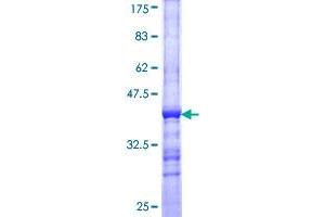 Image no. 1 for Tubby Homolog (TUB) (AA 439-538) protein (GST tag) (ABIN1324096) (TUB Protein (AA 439-538) (GST tag))