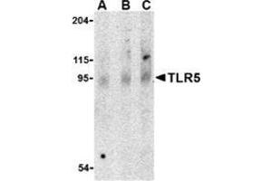 Western blot analysis of TLR5 in rat brain cell lysate with this product at (A) 0.
