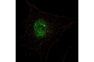 Fluorescent confocal image of SY5Y cells stained with phospho-PDX1-T11 antibody. (PDX1 antibody  (pThr11))