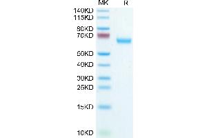 Mouse Glypican 1/GPC1 on Tris-Bis PAGE under reduced condition. (GPC1 Protein (AA 24-529) (His tag))