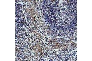 Immunohistochemical analysis of Caspase 3 staining in human tonsil formalin fixed paraffin embedded tissue section. (Caspase 3 antibody)