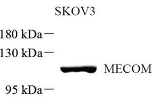 Western blot analysis of MECOM (ABIN7074575) at dilution of 1: 500