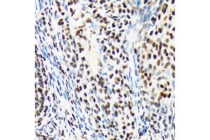 Immunohistochemistry of paraffin-embedded rat ovary using A Rabbit mAb (ABIN7265699) at dilution of 1:100 (40x lens). (ARID1A antibody)
