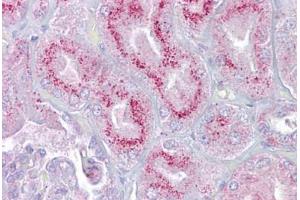 Anti-P2RX2 / P2X2 antibody IHC staining of human kidney. (P2RX2 antibody  (AA 108-157))