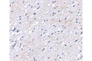 Immunohistochemical staining of human brain tissue using BAIAP3 polyclonal antibody  at 2. (BAIAP3 antibody  (N-Term))