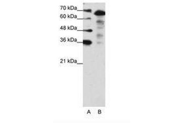 MLXIPL antibody  (N-Term)