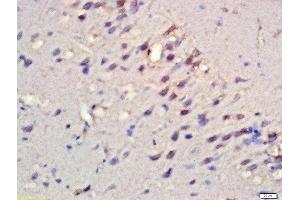 Formalin-fixed and paraffin embedded rat brain labeled with Rabbit Anti-RPS6KB1(Ser427) Polyclonal Antibody, Unconjugated  at 1:200 followed by conjugation to the secondary antibody and DAB staining