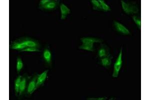 Immunofluorescent analysis of Hela cells using ABIN7160373 at dilution of 1:100 and Alexa Fluor 488-congugated AffiniPure Goat Anti-Rabbit IgG(H+L) (MSH4 antibody  (AA 501-800))