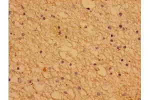 Immunohistochemistry of paraffin-embedded human brain tissue using  at dilution of 1:100 (PTHLH antibody  (AA 37-175))
