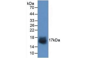 Detection of Recombinant SNCa, Human using Polyclonal Antibody to Synuclein Alpha (SNCa) (SNCA antibody  (AA 1-140))