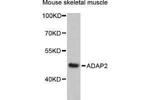 Western blot analysis of extracts of mouse skeletal muscle, using  antibody (ABIN6131170, ABIN6136549, ABIN6136551 and ABIN6217841) at 1:3000 dilution. (ADAP2 antibody  (AA 1-381))