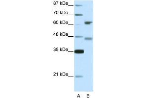 WB Suggested Anti-RFX4 Antibody Titration: 5. (RFX4 antibody  (Middle Region))