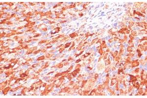 Immunohistochemistry of paraffin-embedded Rat ovary using ASNS Polyclonal Antibody at dilution of 1:100 (40x lens). (Asparagine Synthetase antibody)