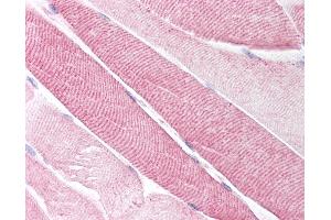 Anti-Neurokinin A Receptor antibody IHC of human skeletal muscle. (TACR2 antibody  (Extracellular Domain))