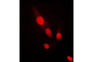 Immunofluorescent analysis of AKT2 staining in HepG2 cells.