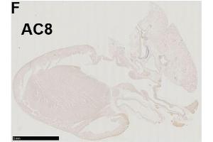 Immunohistochemistry of a left-sided rat heart for adenylyl cyclase AC8 (moderately positive) Source: PMID35625651