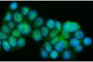 IF analysis of Presenilin 1/PS-1/PSEN1 using anti-Presenilin 1/PS-1/PSEN1 antibody (ABIN7599542).