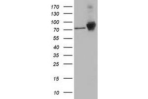 HEK293T cells were transfected with the pCMV6-ENTRY control (Left lane) or pCMV6-ENTRY CTNNB1 (Right lane) cDNA for 48 hrs and lysed. (CTNNB1 antibody)