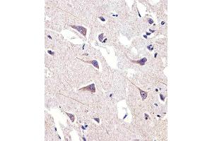 Immunohistochemical analysis of paraffin-embedded H. (FADS2 antibody  (AA 96-122))