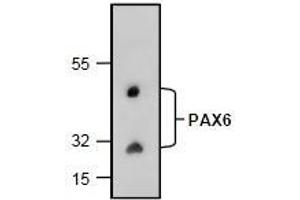 AP26353PU-N: Western blot analysis of PAX6 with rat kidney tissue lysate.