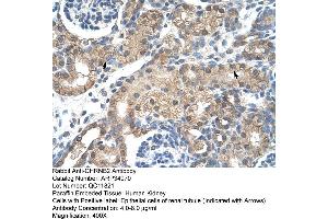 Human kidney (CHRNB2 antibody  (Middle Region))