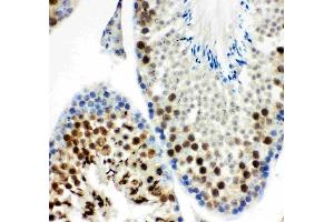 Anti-MCAK antibody, (ABIN3043278), IHC(P)IHC(P): Mouse Testis Tissue (KIF2C antibody  (AA 531-725))