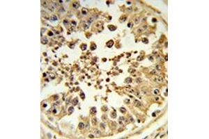 Formalin-fixed and paraffin-embedded human testis tissue reacted with DIAPH2 Antibody , which was peroxidase-conjugated to the secondary antibody, followed by DAB staining. (DIAPH2 antibody  (Middle Region))