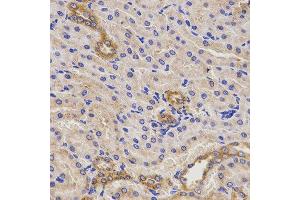 Immunohistochemistry of paraffin-embedded rat kidney using TNFRSF1B antibody at dilution of 1:200 (x400 lens). (TNFRSF1B antibody)