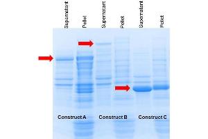 SDS-PAGE of Construct A, B and C plasmids transformed in E.