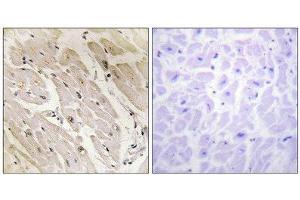 Immunohistochemistry (IHC) image for anti-Protein Kinase, AMP-Activated, gamma 2 Non-Catalytic Subunit (PRKAG2) (N-Term) antibody (ABIN1850044) (PRKAG2 antibody  (N-Term))