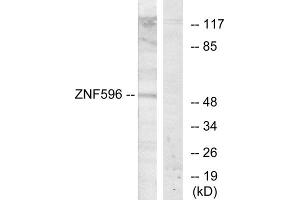 Western blot analysis of extracts from Jurkat cells, using ZNF596 antibody. (ZNF596 antibody  (Internal Region))
