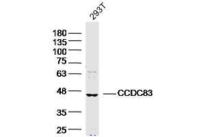 293T Cell lysates probed with CCDC83 Polyclonal Antibody, unconjugated  at 1:300 overnight at 4°C followed by a conjugated secondary antibody for 60 minutes at 37°C. (CCDC83 antibody  (AA 101-200))