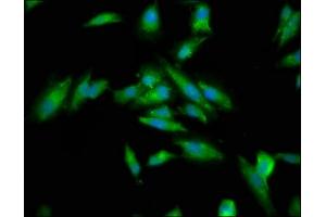 Immunofluorescence (IF) image for anti-Cytoskeleton Associated Protein 5 (CKAP5) (AA 1802-2019) antibody (ABIN7149368)