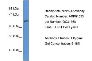 Western Blotting (WB) image for anti-Inositol Polyphosphate-5-Phosphatase, 145kDa (INPP5D) (C-Term) antibody (ABIN2774303) (INPP5D antibody  (C-Term))