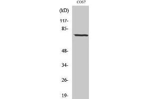 Western Blotting (WB) image for anti-Netrin 1 (NTN1) (C-Term) antibody (ABIN3176270) (Netrin 1 antibody  (C-Term))