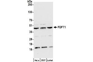 Western Blotting (WB) image for anti-Farnesyl-Diphosphate Farnesyltransferase 1 (FDFT1) (AA 367-417) antibody (ABIN7450244)