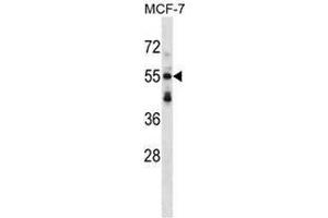 Western blot analysis in MCF-7 cell line lysates (35ug/lane) using Syntrophin-3 / SNTB2 Antibody .