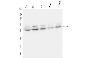 anti-UPF3 Regulator of Nonsense Transcripts Homolog B (UPF3B) (AA 416-452), (C-Term) antibody