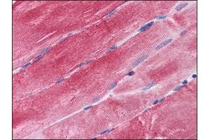 Immunohistochemistry Image: Human Skeletal Muscle: Formalin-Fixed, Paraffin-Embedded (FFPE) (BAG3 antibody  (C-Term))