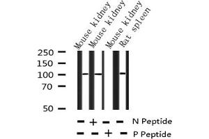Western blot analysis of Phospho-NF kappaB p105/p50 (Ser932) expression in various lysates (NFKB1 antibody  (pSer932))