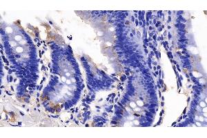 Detection of AXIN in Rat Colon Tissue using Polyclonal Antibody to Axis Inhibition Protein (AXIN)