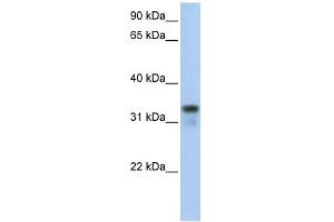 GLYATL2 antibody used at 1 ug/ml to detect target protein. (GLYATL2 antibody  (Middle Region))