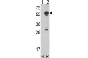 Western Blotting (WB) image for anti-Inhibin, alpha (INHA) antibody (ABIN3002774) (Inhibin alpha antibody)