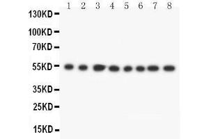 Lane 8: JURKAT Cell Lysate (DLD antibody  (C-Term))
