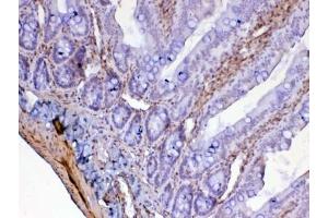 IHC testing of FFPE rat small intestine tissue with Galectin 1 antibody at 1ug/ml. (LGALS1/Galectin 1 antibody)