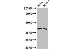 Western Blot Positive WB detected in: Hela whole cell lysate, MCF-7 whole cell lysate All lanes: HLA-B antibody at 3. (HLA-B antibody  (AA 197-306))